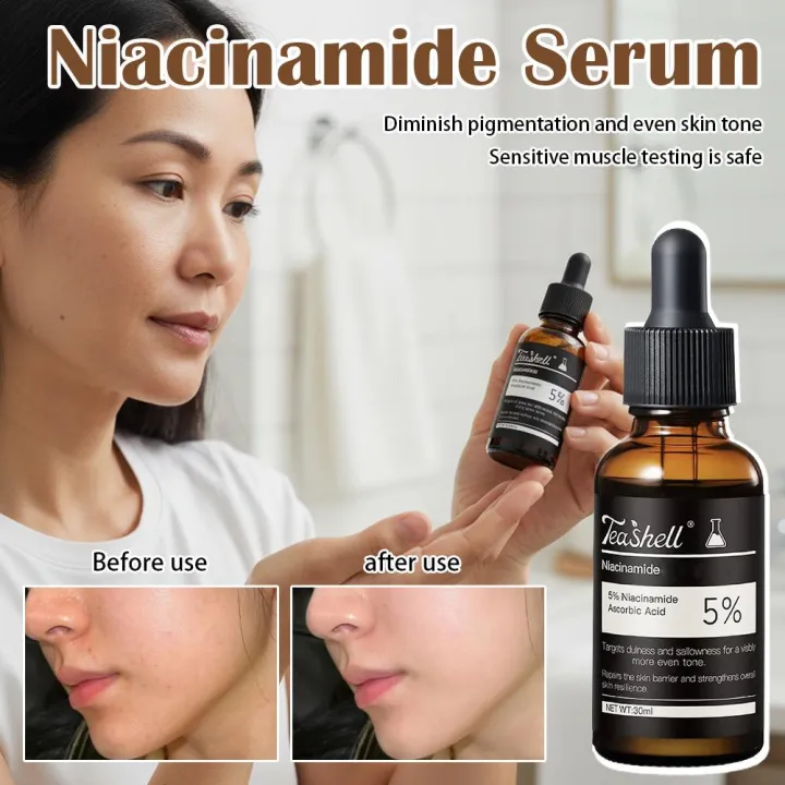 Teashell%20Serum%205%25%20Niacinamide%20&%20Arbutin%2030ml%20Fade%20Dark%20Spots%20Skin%20Moisturizing%20Hydration%20Sensitive%20Skin%20teashell%20teashell%20serum%20teashell%20teashell%20serum%20teashell%20teashell%20serum%20-%20Image%204