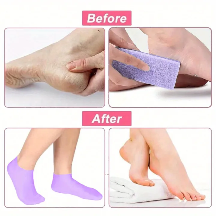 Moisturizing%20Foot%20Socks,Silicone%20Socks%20for%20Dry%20Cracked%20Feet%20Women's%20Foot%20Socks%20for%20Moisturizing,Featuring%20Massage%20-%20Image%205
