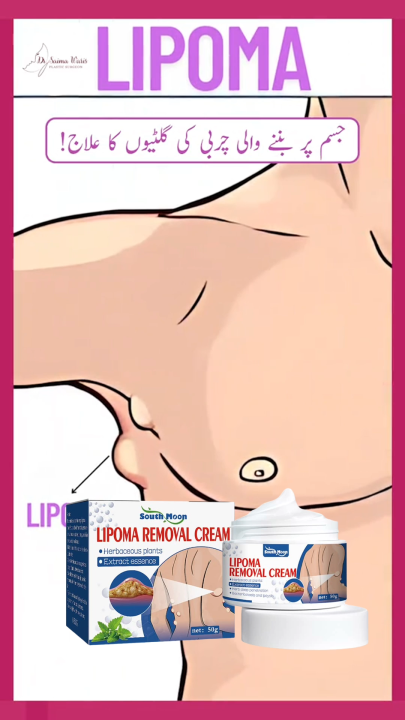 Lipo-PRO Lipoma Remover Cream | Easy At-Home Lipoma Care | Daraz.pk