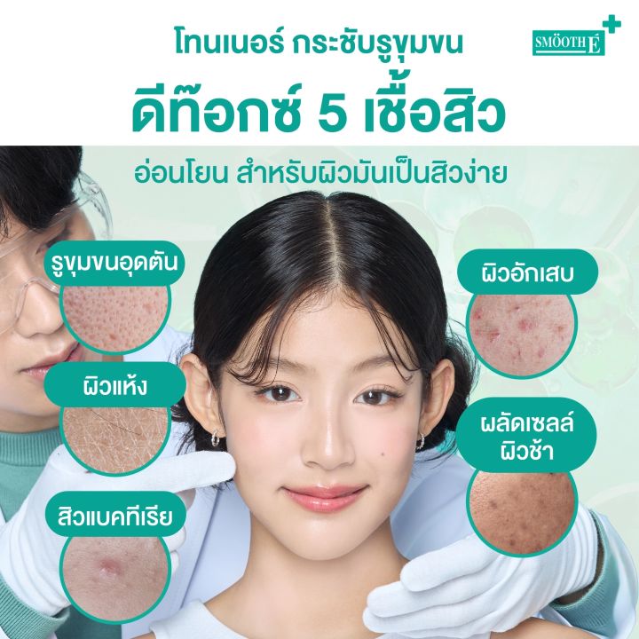 Smooth%20E%20acne-5%20pore%20clear%20Whitening%20Toner%20smooth%20e%20acne%20clear%20Whitening%20Toner%20%5B3%20bottles%5D%204in1%20Toner%20reduce%20acne%20problem%20-%20Image%202