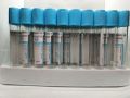 Pt tube 10mL (Sodium Citrate)for PRP XINLE. 