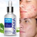 Bioaqua Anti-Acne Serum Removal Of Acne Essence Liquid 30ML. 