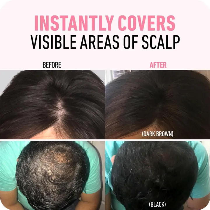 Hairline%20Shadow%20Powder,Instantly%20Conceal%20Hairline%20And%20Hair%20Root,%20Waterproof%20Hairline%20Powder%20Filler,Hair%20Root%20Cover,Scalp%20Powder%20staloofy%20hair%20-%20Image%202