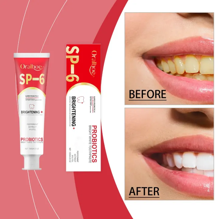Oralhoe%20SP-6%20Super%20Probiotic%20Bright%20White%20Toothpaste%20-%20120g/4.23oz%20-%20Image%203