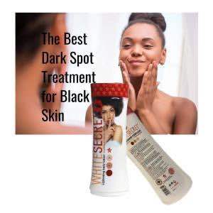 WHITE%20SECRET%20Lightening%20Body%20Lotion%20-%20Image%202