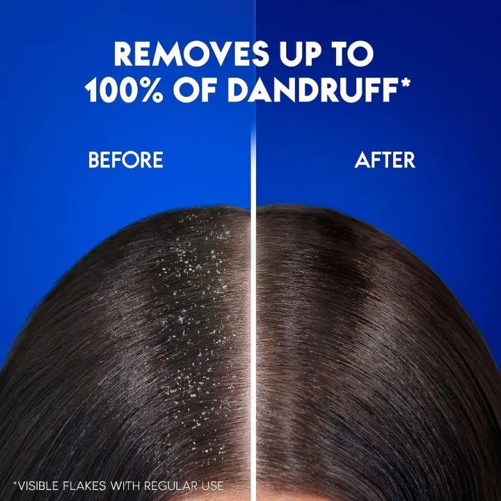 Head%20&%20Shoulders%20Anti%20Dandruff%20Shampoo%20Cool%20Menthol%20650ml%20-%20Image%202
