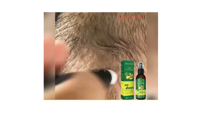 Organic Ginger Oil China Ginger Hair Growth Serum Sprayer Fast Hair Growth Dense Regrowth Ginger Serum Oil Natural Hair Growth Accelerator For Stronger