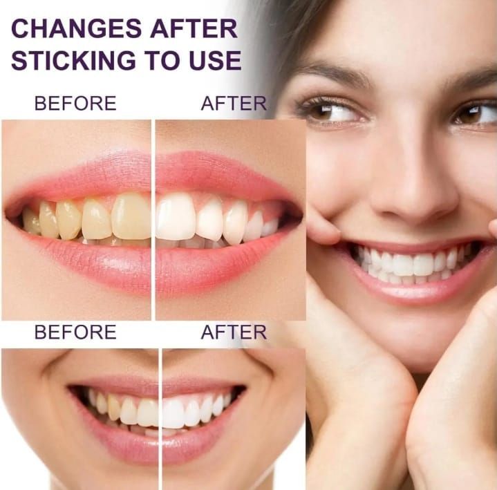 Eelhoe%20Teeth%20Whitening%20colour%20corrector%20v34%2030%20ml%20-%20Image%204