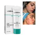 Authentic LANBENA Acne Treatment Gel -20g. 