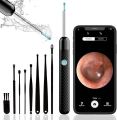 This Earwax Removal Camera Is Equal Parts Satisfying And Disgusting. 