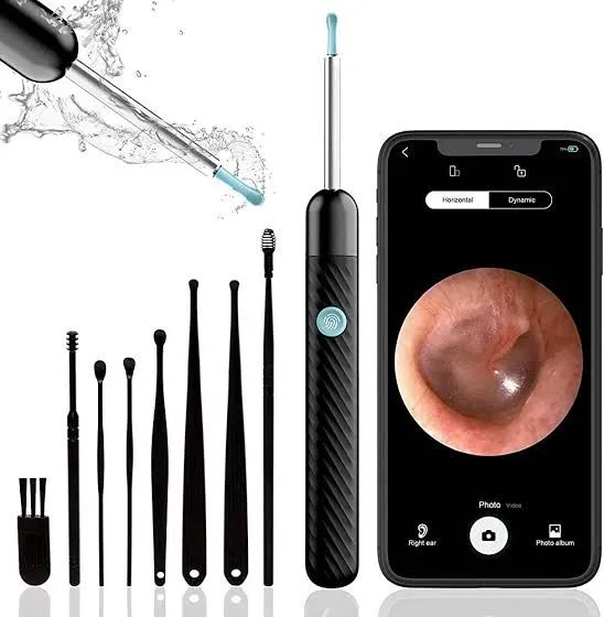 This%20Earwax%20Removal%20Camera%20Is%20Equal%20Parts%20Satisfying%20And%20Disgusting%20-%20Image%203
