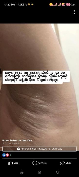 Dove%20Ultimate%20Repair%20Darkmarks%20Corrector%20Roll%20On%20Stick%20%7B%20Uk%20Made%20%7D%20-%20Image%205