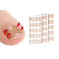 professional Nail Correction Stickers Ingrown Toenail Corrector Patches Paronychia Treatment Recover Corrector Pedicure Tools. 