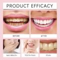 Oralhoe SP-6 Brightening + PROBIOTICS Bright White Toothpaste. 