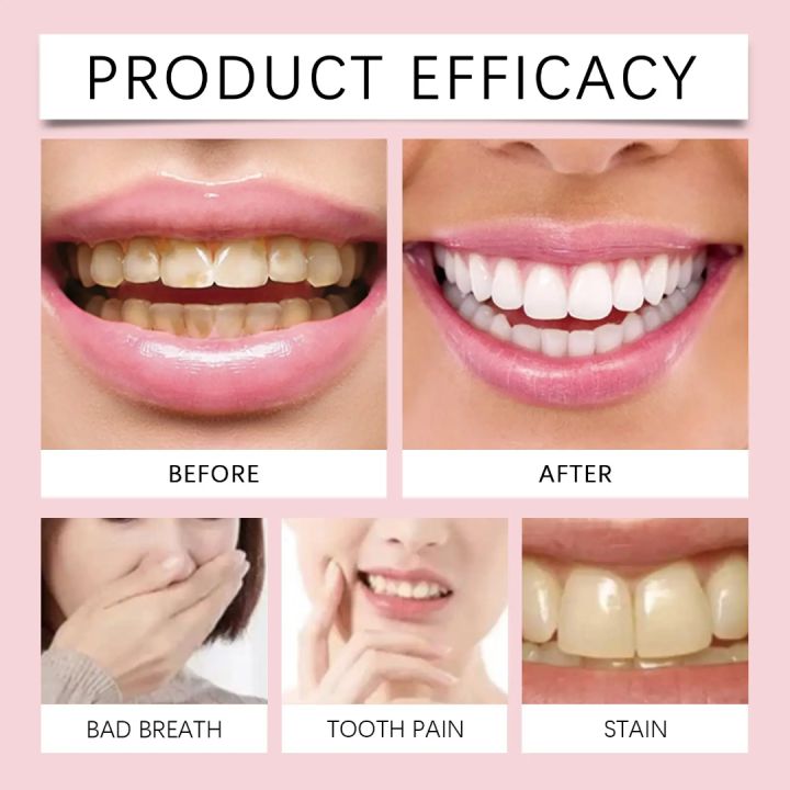 Oralhoe%20SP-6%20Brightening%20+%20PROBIOTICS%20Bright%20White%20Toothpaste%20-%20Image%204