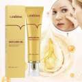 LanBeNa - TCM SCAR AND ACNE MARK REMOVAL GEL OINTMENT (30g) Acne Scar Cream. 