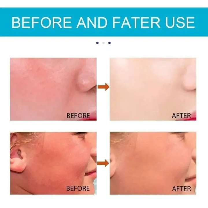 JAYSUING%20SPF%2050+%20Moisturiser%20Sun%20Stick%20-%2020gm%20-%20Image%205