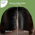 Pilgrim Australian Tea Tree Non-Drying Anti-Dandruff Shampoo For Prevents Dandruff Recurrence 200 ml. 