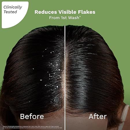 Pilgrim%20Australian%20Tea%20Tree%20Non-Drying%20Anti-Dandruff%20Shampoo%20For%20Prevents%20Dandruff%20Recurrence%20200%20ml%20-%20Image%204