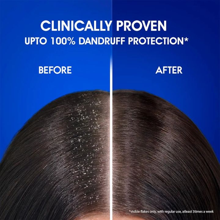 Indian%20Product%20Head%20&%20Shoulders%20Anti-dandruff%20Smooth%20&%20Silky%20Shampoo%20Used%20For%20male%20/Female...1000%20Ml%20-%20Image%208