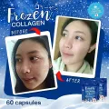 Frozen Collagen 2 in 1 Whitening 10x Glutathione. 