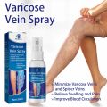 OUHOE Varicose Vein Spray (30ml).