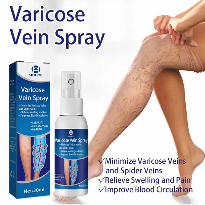 OUHOE Varicose Vein Spray (30ml)