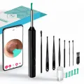 Smart Visual Ear Cleaner with Hd Camera Led Light Wireless Ear Wax Removal Tool Limited Stock Offer.