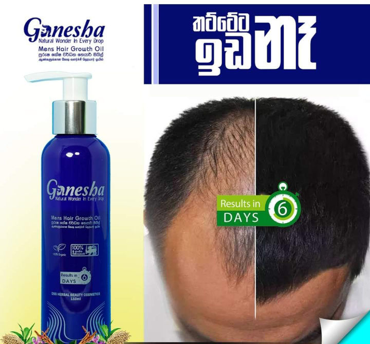 Ganesha%20Mens%20Hair%20Growth%20Oil%20110ml%20-%20Image%202