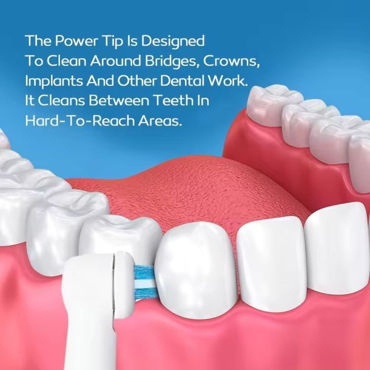 Ortho%20and%20Power%20Tip%20Brush%20Heads%20Compatible%20with%20Oralb%20Electric%20Toothbrush%20-%20Good%20for%20Braces,%20Crowns,%20Bridges%20Fit%20Oral%20B%20Pro%201000%20-%20Image%203