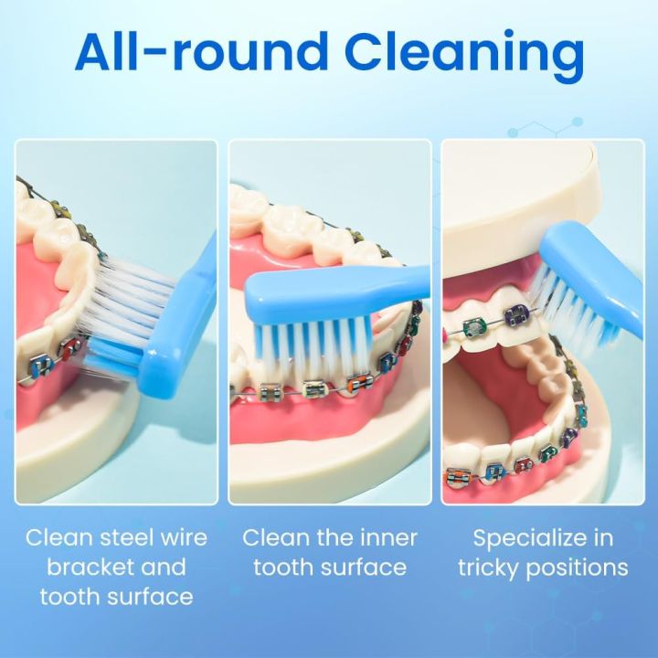 Dental%20V-Shaped%20Orthodontic%20Toothbrush%20for%20Braces%20Dental%20Soft%20Bristle%20with%20Inter%20Dental%20Brush%20Set%20Oral%20Brackets%20Cleaning%20Kit%20-%20Image%202