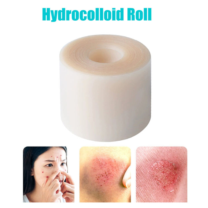 1Pcs%20Hydrocolloid%20Roll%20For%20Wound%20Care%20Hydrocolloid%20Patch%20Bandages%20With%20Self-Adhesive%20Bed%20Sore%20Bandages%20Highly%20Absorbent%20For%20Burn%20-%20Image%202