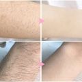 2 Minutes Painless Fast Hair Removal Spray Hair Growth Inhibitor Arm Armpit Leg Permanent Depilatory for Men Women Repair Care.