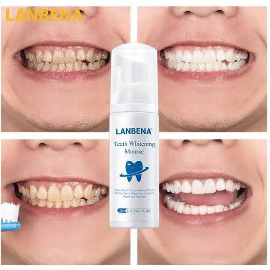 LANBENA%20Teeth%20Whitening%20Mousse%20(60ml)%20Rich%20&%20Delicate%20Foam%20-%20Clean%20Teeth%20Stain,%20Freshen%20Breath,%20Whiten%20Teeth,%20Strengthen%20Enamel,%20Repair%20Oral%20Damage%20-%20Image%203