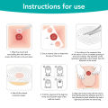 10Pcs Colostomy Bags Disposable Adhesive One Piece Drainable Ostomy Pouch Supplies for Ileostomy One Piece Colostomy Bags. 