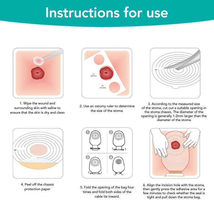 10Pcs%20Colostomy%20Bags%20Disposable%20Adhesive%20One%20Piece%20Drainable%20Ostomy%20Pouch%20Supplies%20for%20Ileostomy%20One%20Piece%20Colostomy%20Bags%20-%20Image%204