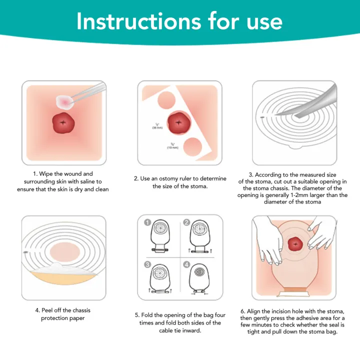 10Pcs%20Colostomy%20Bags%20Disposable%20Adhesive%20One%20Piece%20Drainable%20Ostomy%20Pouch%20Supplies%20for%20Ileostomy%20One%20Piece%20Colostomy%20Bags%20-%20Image%204