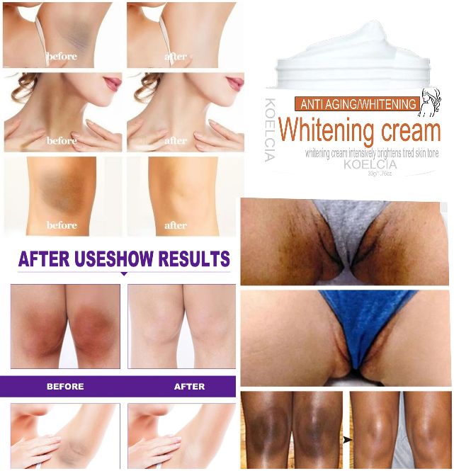 WHITENING CREAM skin lightening FOR intimate area private parts and underarm