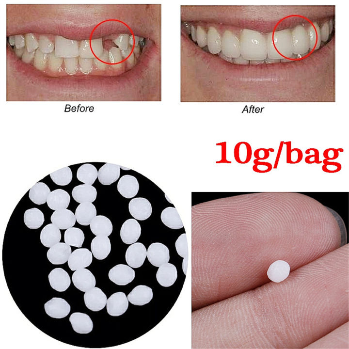 10g/Bag%20Tooth%20Repair%20Kit-Thermal%20Beads%20for%20Filling%20Fix%20The%20Missing%20and%20Broken%20Tooth%20or%20Adhesive%20The%20Denture%20Fake%20Teeth%20-%20Image%202