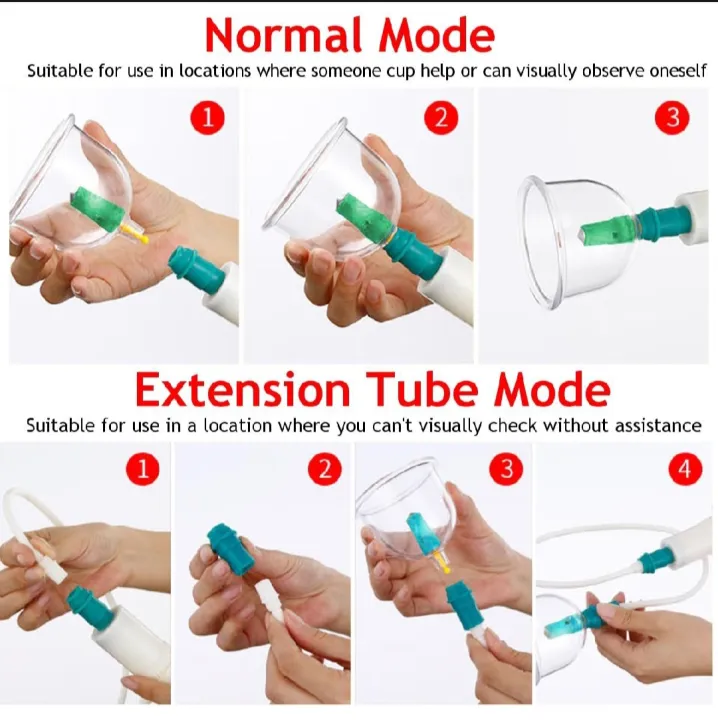 12%20Cups%20Professional%20Acupoint%20Cupping%20Set%20Acupuncture%20Cupping%20Therapy%20Kit%20Cellulite%20Massage%20Kit%20-%20Image%203