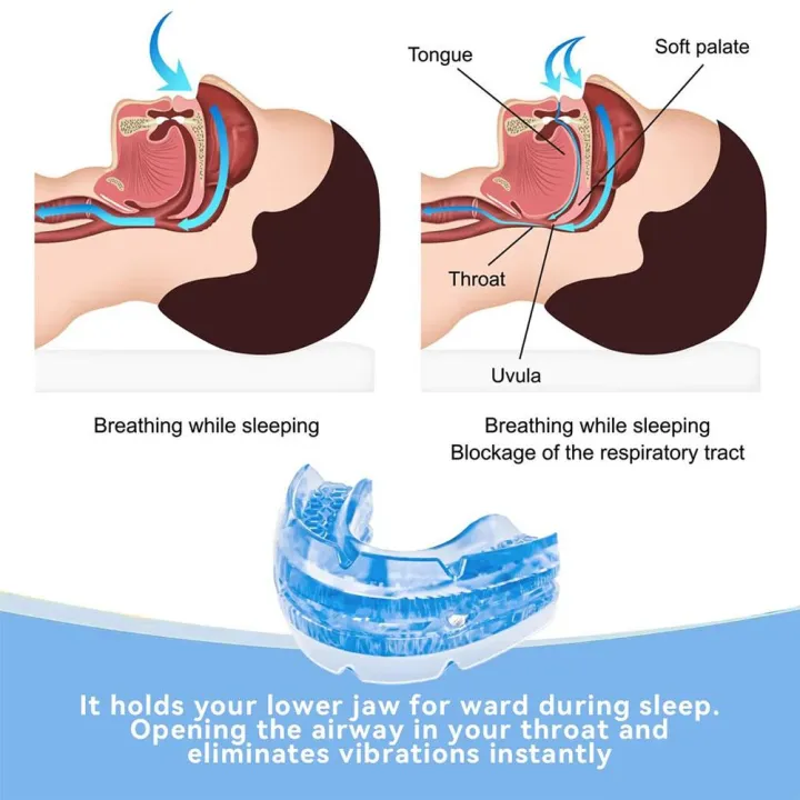 Anti-Snoring%20Device%20Anti%20Snoring%20Mouthpiece%20Mouth%20Guard%20for%20Women%20Men%20Snore%20Reducing%20Most%20Comfortable%20Adjustable%20Oral%20Appliance%20-%20Image%205