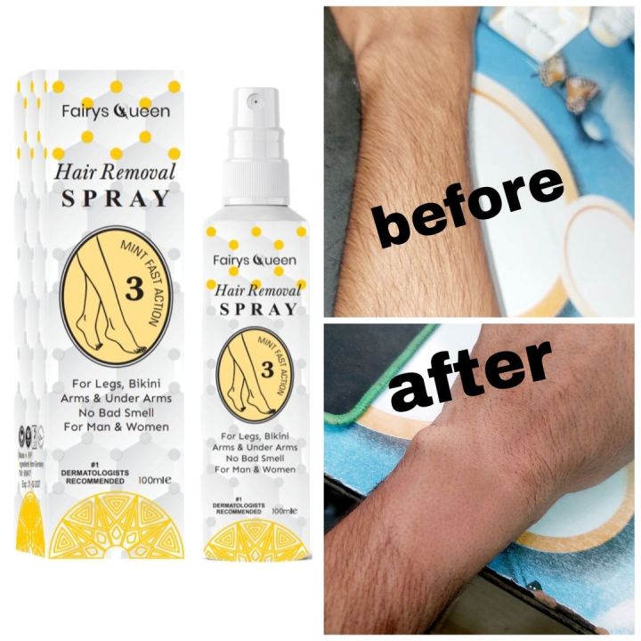 Fairy's%20Queen%20Hair%20Removal%20Spray%20100ml,%20For%20Legs,%20Bikini%20Arms%20&%20Under%20Arms,%20No%20Bad%20Smell,%20For%20Man%20&%20Women%20-%20Image%205