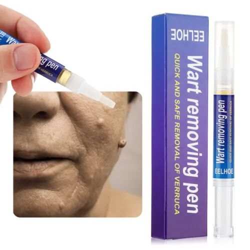 Quick%20Wart%20Removal%20Pen%20-%20Fast%20Acting,%20Safe%20Wart%20Removal%20Treatment%20%7C%20Effective%20Wart%20Removal%20Solution%20for%20Clear%20Skin%20%7C%20Eelhoe%20Skin%20Care%20for%20All%20Types%20of%20Warts%20-%20Image%206