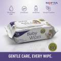 Baby Wet Wipes | Baby Wipes | Wet Wipes | SOFTA CARE | 80pcs Per Pack | 1 Set. 