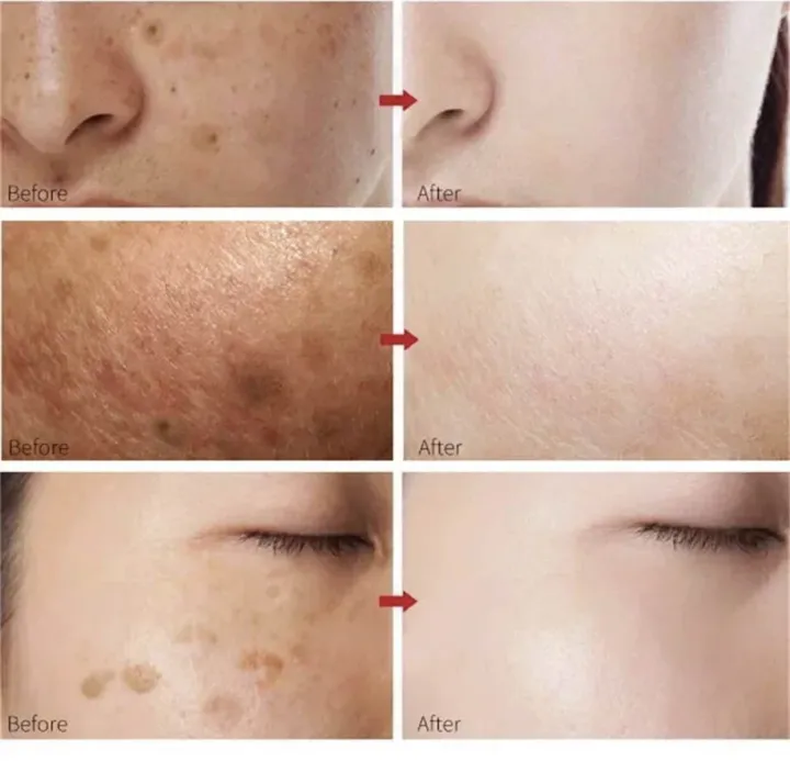 White%20Rice%20Face%20Whitening%20Cream%20Remove%20Dark%20Spots%20Fade%20Freckle%20Melanin%20Anti%20Wrinkle%20Aging%20Moisturizing%20Brighten%20Skin%20Care%20-%20Image%206