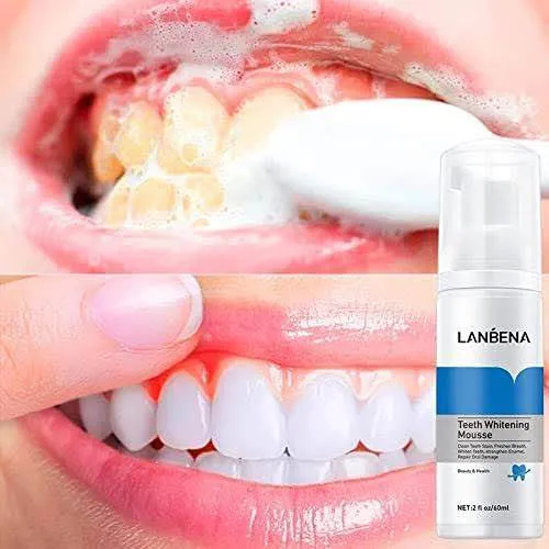 LANBENA%20Teeth%20Whitening%20Mousse%20(60ml)%20Rich%20&%20Delicate%20Foam%20-%20Clean%20Teeth%20Stain,%20Freshen%20Breath,%20Whiten%20Teeth,%20Strengthen%20Enamel,%20Repair%20Oral%20Damage%20-%20Image%204