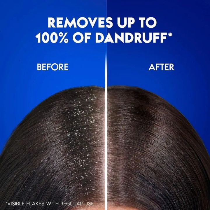 Head%20&%20Shoulders%20Charcoal%20Detox%20Anti-Dandruff%20Shampoo%20400ml%20Dubai%20-%20Image%206