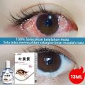 Lutein Eye Drops Relieve Fatigue Presbyopia Improve Vision Eye 13ml.