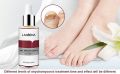 International Product Lanvena Nail Repair Essence Serum for Fungal Nail Treatment- 12ml. 