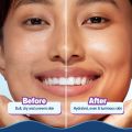 Aqualogica Illuminate + Hydra Gel Moisturizer with Wild Berries & Alpha Arbutin-200g|24 Hour Intense Hydration|Water-Like Gel Texture|Non-Sticky & Quick Absorbing for Luminous Skin. 